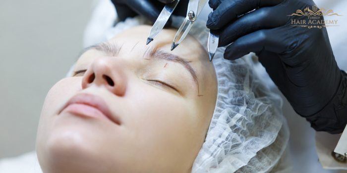 Eyebrow Transplant