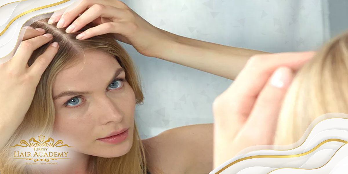La lista de análisis que las mujeres deben hacer antes del trasplante de cabello