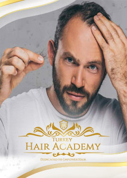 ¿Es correcto el trasplante de cabello mientras continúa la caída del cabello?