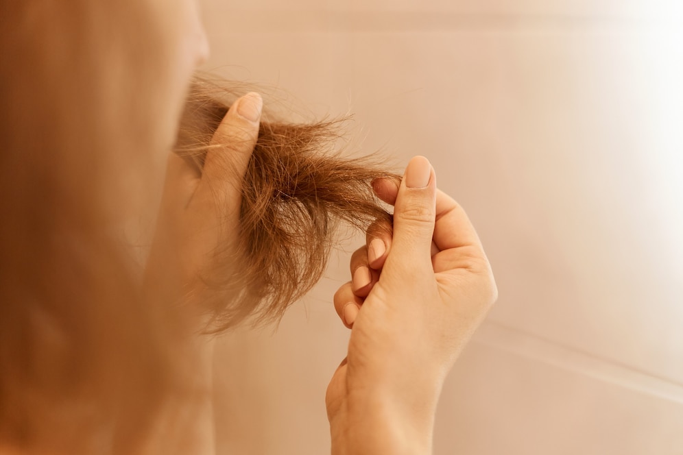 Women Hair Loss
