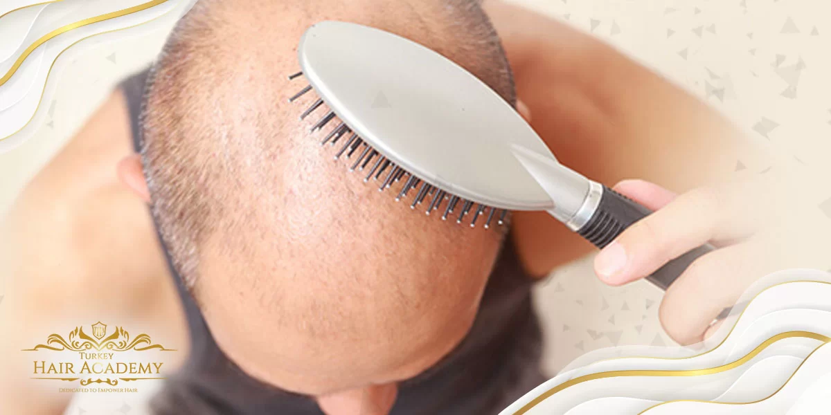 Quanto tempo ci vuole per far crescere nuovi capelli?